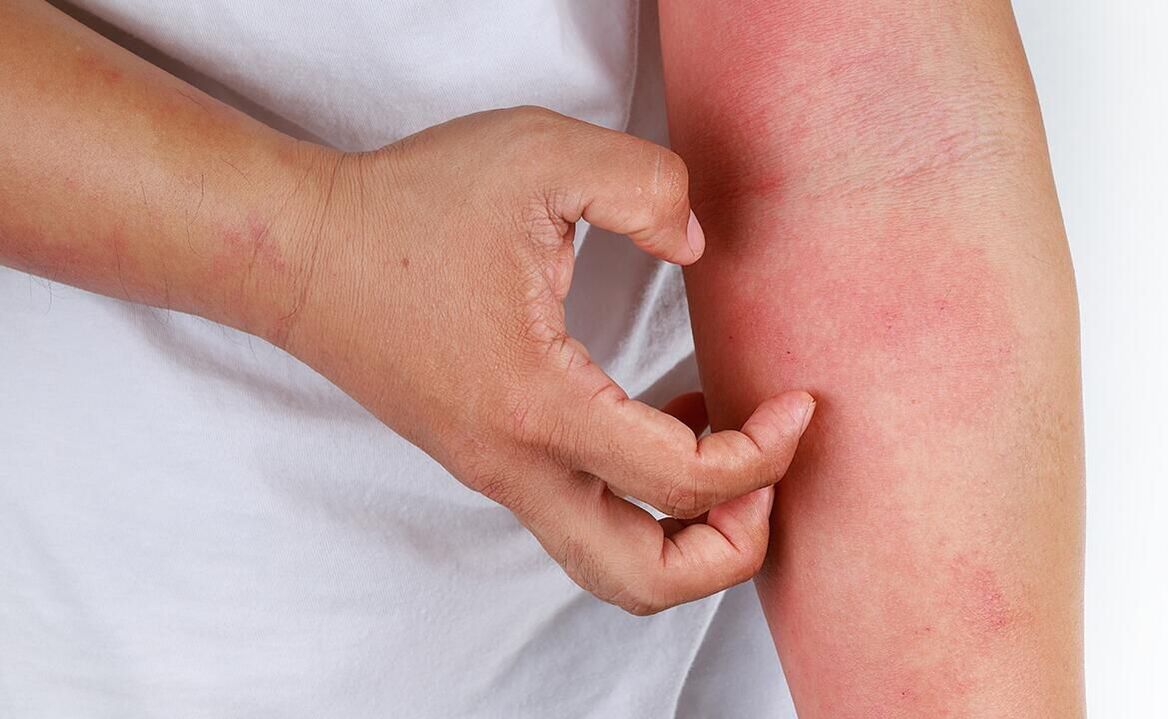 عوارض احتمالی استفاده از نوشابه